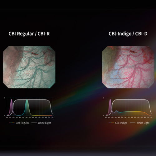 Відеоендоскопічна система AQ-150 Pro