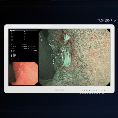 Відеоендоскопічна система AQ-150 Pro