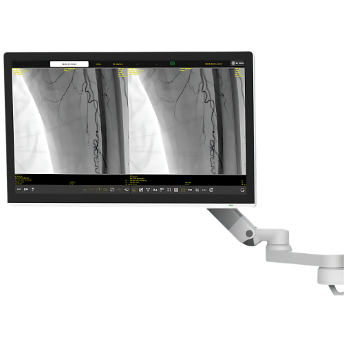 Рентгенівська система типу С-дуга TCA 7 Compact