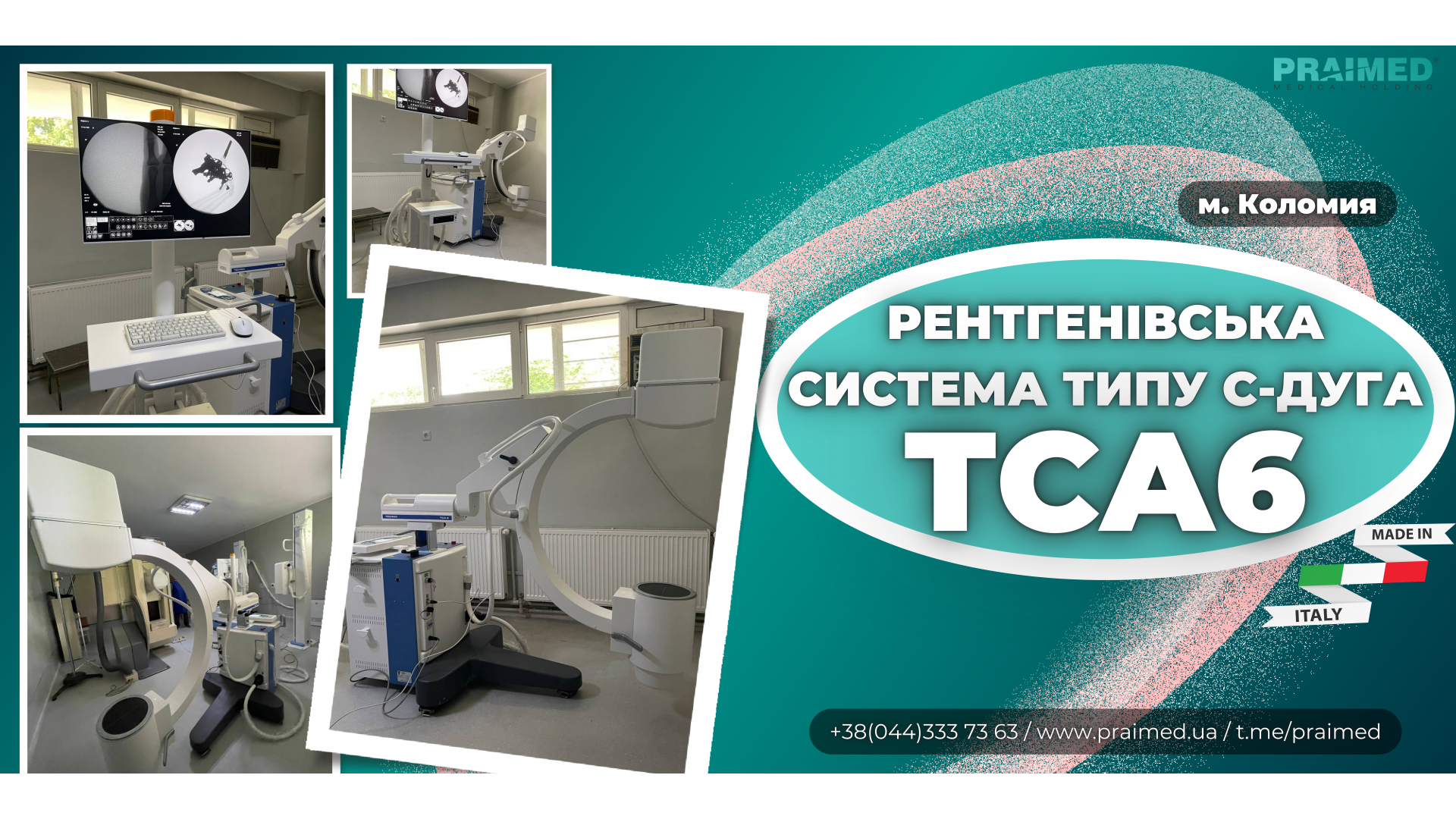 The X-ray system of the C-arc TSA6 type has been successfully installed in the city of Kolomyia