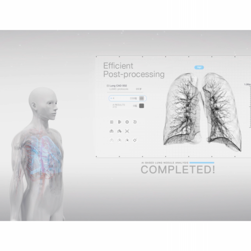 Computed tomography uCT520