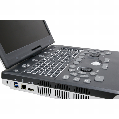 Diagnostic ultrasonic system Apogee 1000