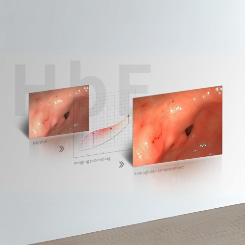 Endoscopic system AC-1