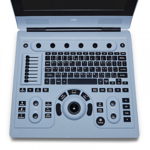 Ultrasound system U60