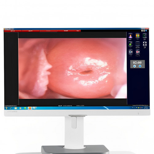 Videocolposcope KN-2200B