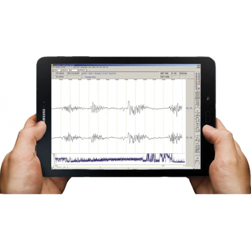 Patient Monitor for Sienna Ultimate ECG